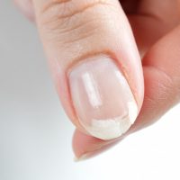 nail problems treatment easy dermatologist